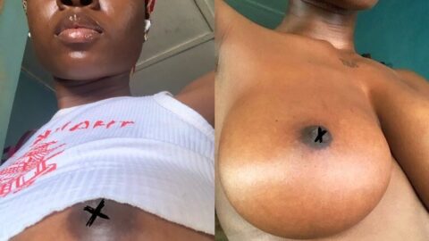 Nude Pictures of Nurse Yahweh Goes Viral