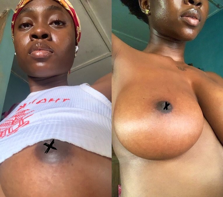 Nude Pictures of Nurse Yahweh Goes Viral