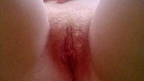 Albino Girl Nude Pictures Leaked Online